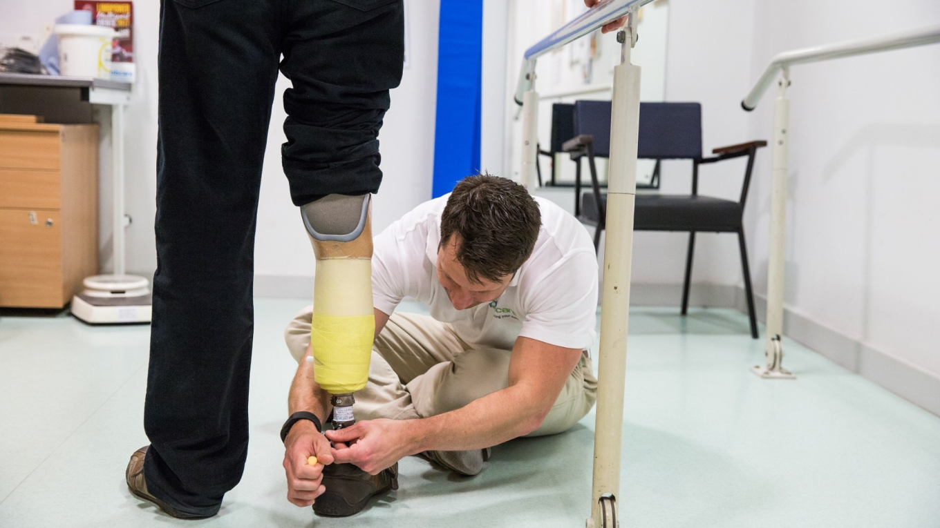 prosthetics